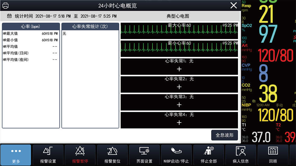 24小时心电概览